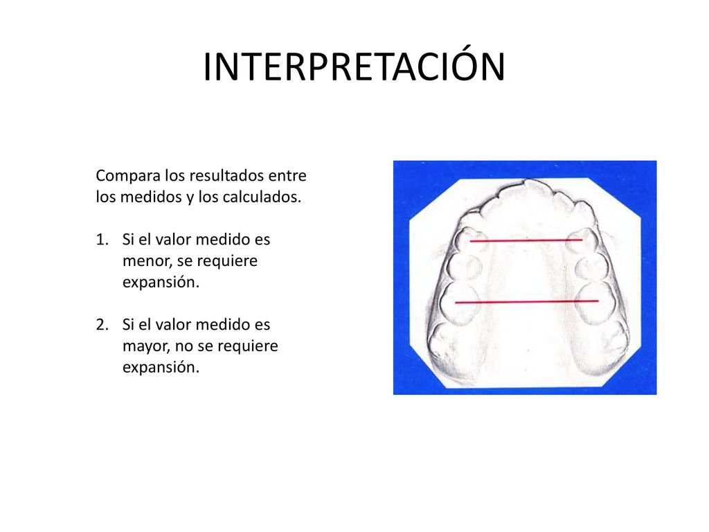 INTERPRETACIÓN Compara los resultados entre los medidos y los calculados. Si el valor medido es menor, se requiere expansión.