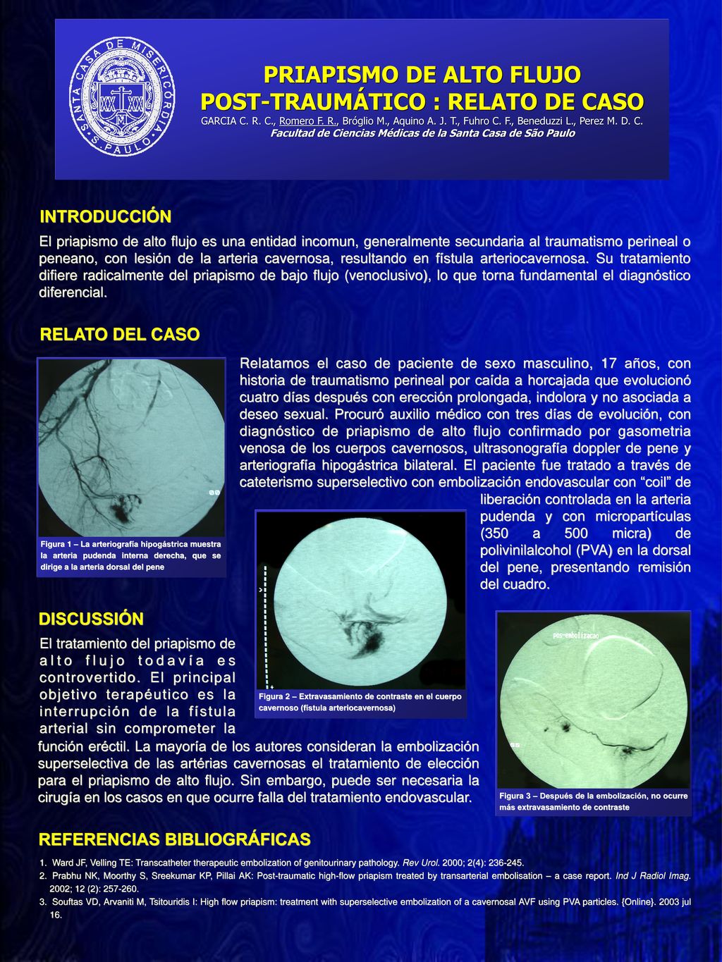 PRIAPISMO DE ALTO FLUJO POST-TRAUMÁTICO : RELATO DE CASO GARCIA C. R. C., Romero F. R., Bróglio M., Aquino A. J. T., Fuhro C. F., Beneduzzi L., Perez M. D. C. Facultad de Ciencias Médicas de la Santa Casa de São Paulo