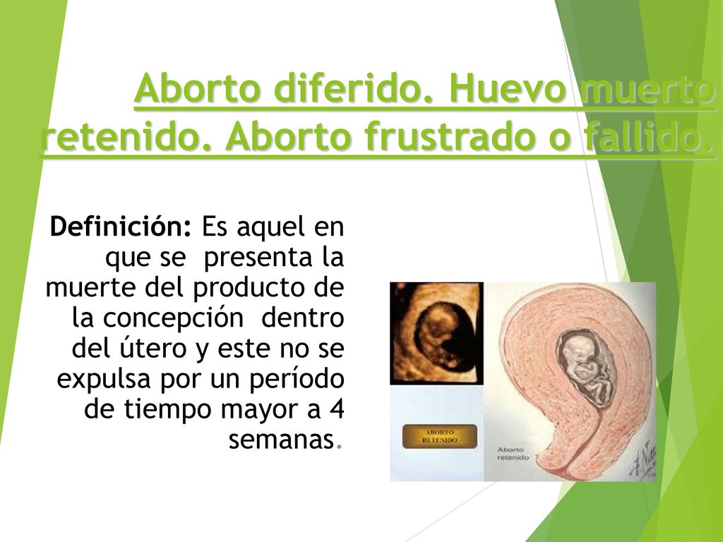 Aborto diferido. Huevo muerto retenido. Aborto frustrado o fallido.