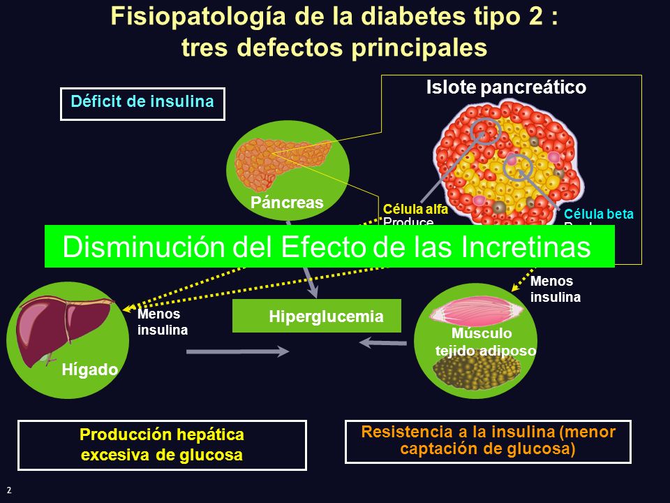 Fisiopatología de la diabetes tipo 2 : tres defectos principales