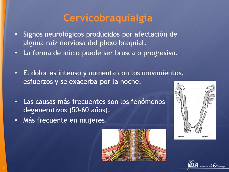 Cervicobraquialgia Signos neurológicos producidos por afectación de alguna raíz nerviosa del plexo braquial.
