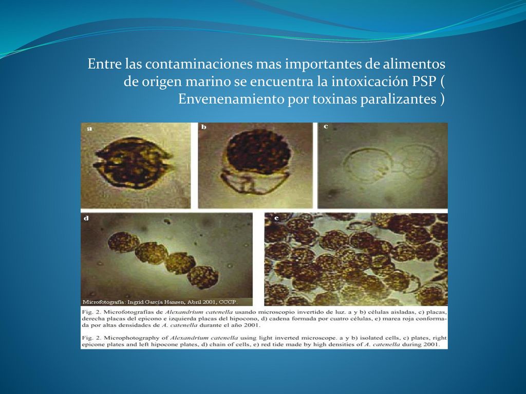 Entre las contaminaciones mas importantes de alimentos de origen marino se encuentra la intoxicación PSP ( Envenenamiento por toxinas paralizantes )
