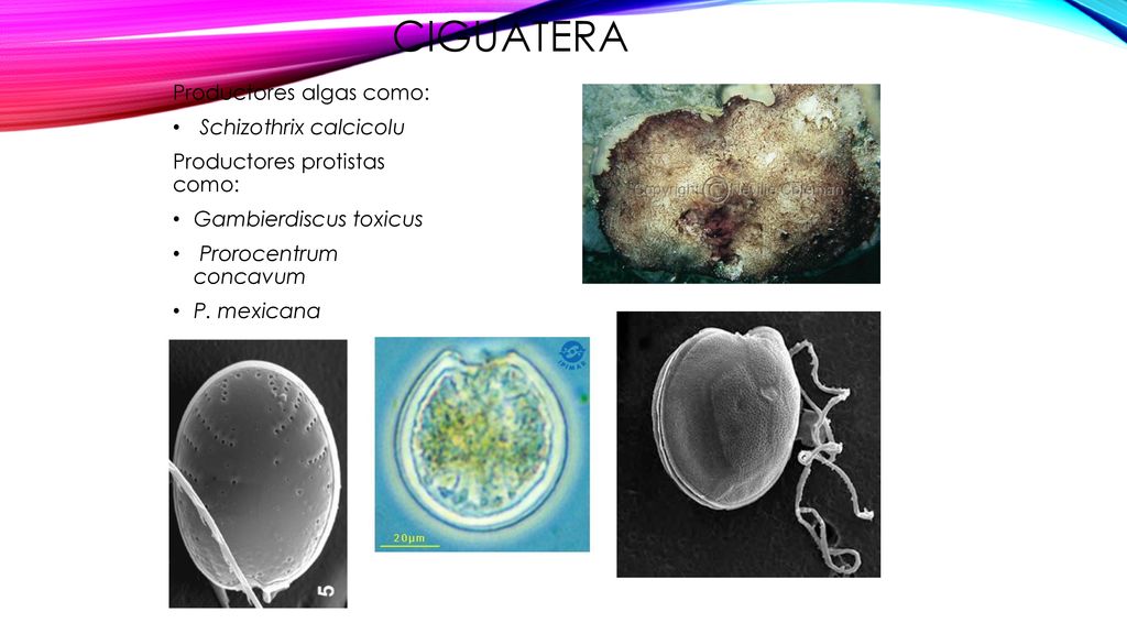 Ciguatera Productores algas como: Schizothrix calcicolu