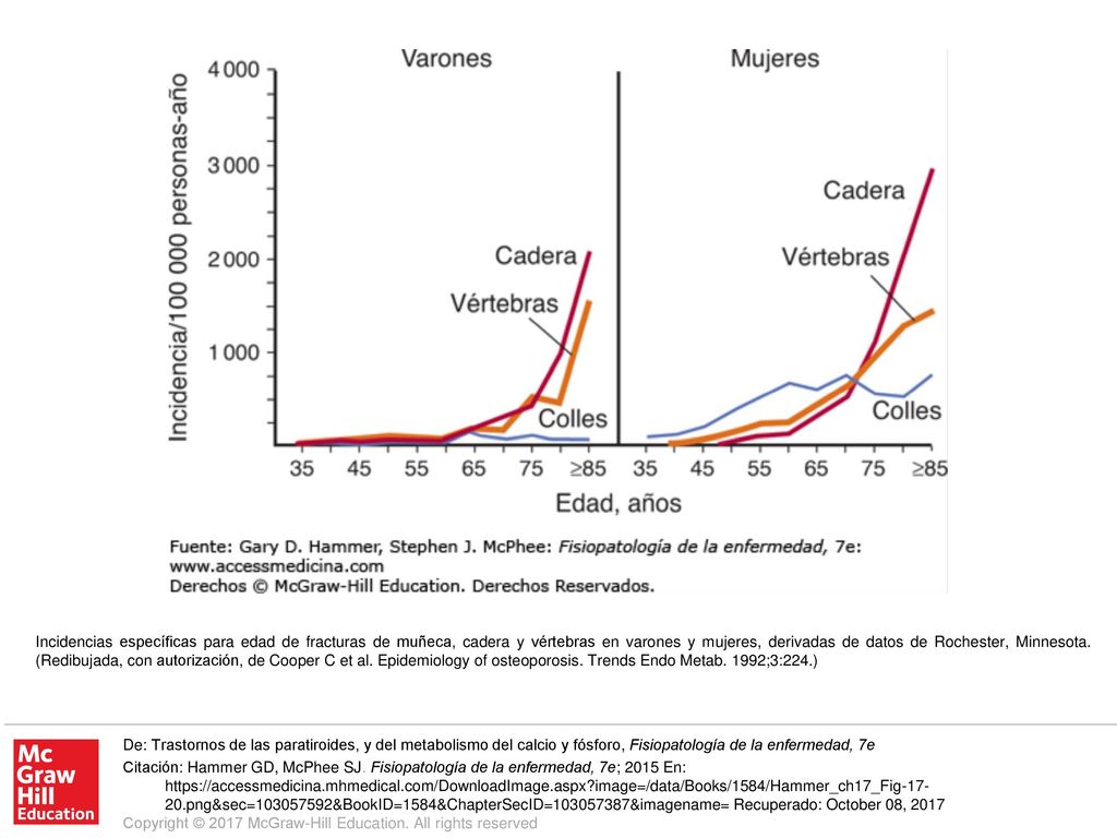 Incidencias específicas para edad de fracturas de muñeca, cadera y vértebras en varones y mujeres, derivadas de datos de Rochester, Minnesota. (Redibujada, con autorización, de Cooper C et al. Epidemiology of osteoporosis. Trends Endo Metab. 1992;3:224.)