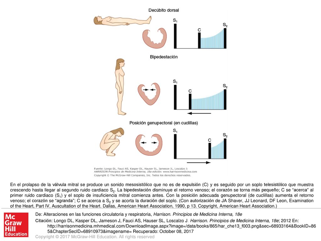 En el prolapso de la válvula mitral se produce un sonido mesosistólico que no es de expulsión (C) y es seguido por un soplo telesistólico que muestra crescendo hasta llegar al segundo ruido cardiaco S2. La bipedestación disminuye el retorno venoso; el corazón se torna más pequeño; C se acerca al primer ruido cardiaco (S1) y el soplo de insuficiencia mitral comienza antes. Con la posición adecuada genupectoral (de cuclillas) aumenta el retorno venoso; el corazón se agranda ; C se acerca a S2 y se acorta la duración del soplo. (Con autorización de JA Shaver, JJ Leonard, DF Leon, Examination of the Heart, Part IV, Auscultation of the Heart. Dallas, American Heart Association, 1990, p 13. Copyright, American Heart Association.)