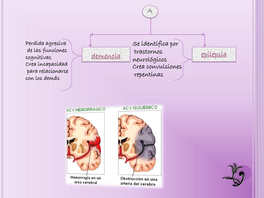 A epilepsia demencia Se identifica por trastornos neurológicos