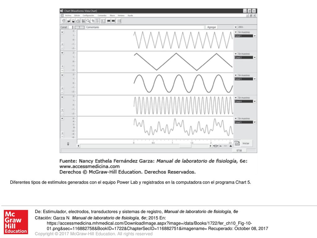 Diferentes tipos de estímulos generados con el equipo Power Lab y registrados en la computadora con el programa Chart 5.