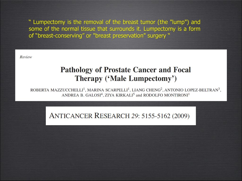 Lumpectomy is the removal of the breast tumor (the lump ) and some of the normal tissue that surrounds it.