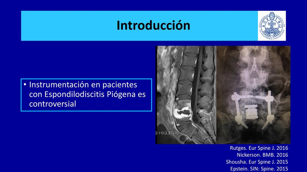Introducción Instrumentación en pacientes con Espondilodiscitis Piógena es controversial. Rutges. Eur Spine J