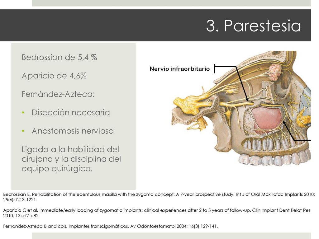 3. Parestesia Bedrossian de 5,4 % Aparicio de 4,6% Fernández-Azteca: