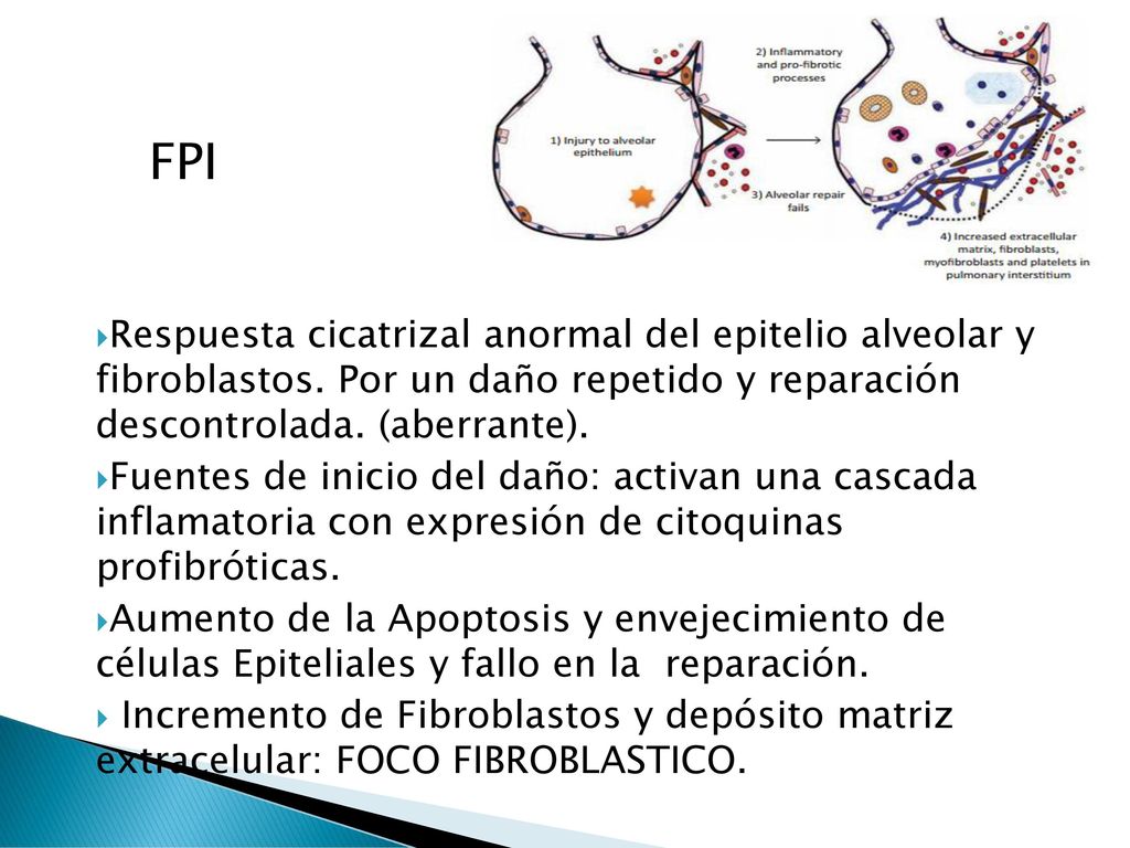 FPI Respuesta cicatrizal anormal del epitelio alveolar y fibroblastos. Por un daño repetido y reparación descontrolada. (aberrante).