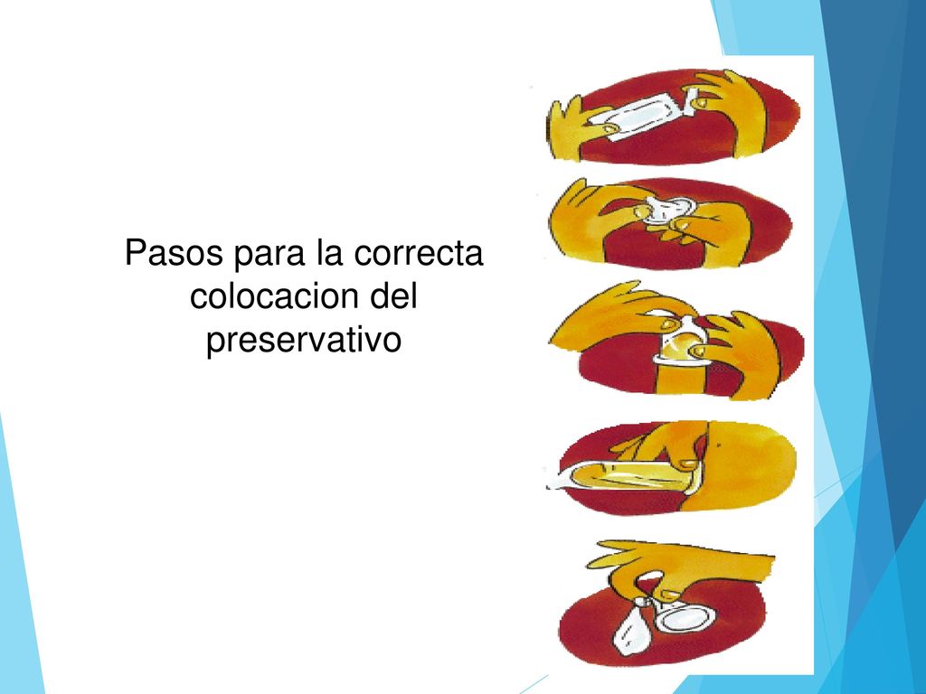 Pasos para la correcta colocacion del preservativo