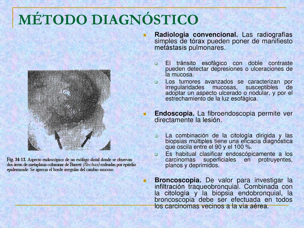 MÉTODO DIAGNÓSTICO Radiología convencional. Las radiografías simples de tórax pueden poner de manifiesto metástasis pulmonares.