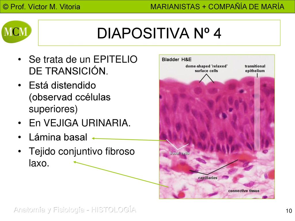 DIAPOSITIVA Nº 4 Se trata de un EPITELIO DE TRANSICIÓN.