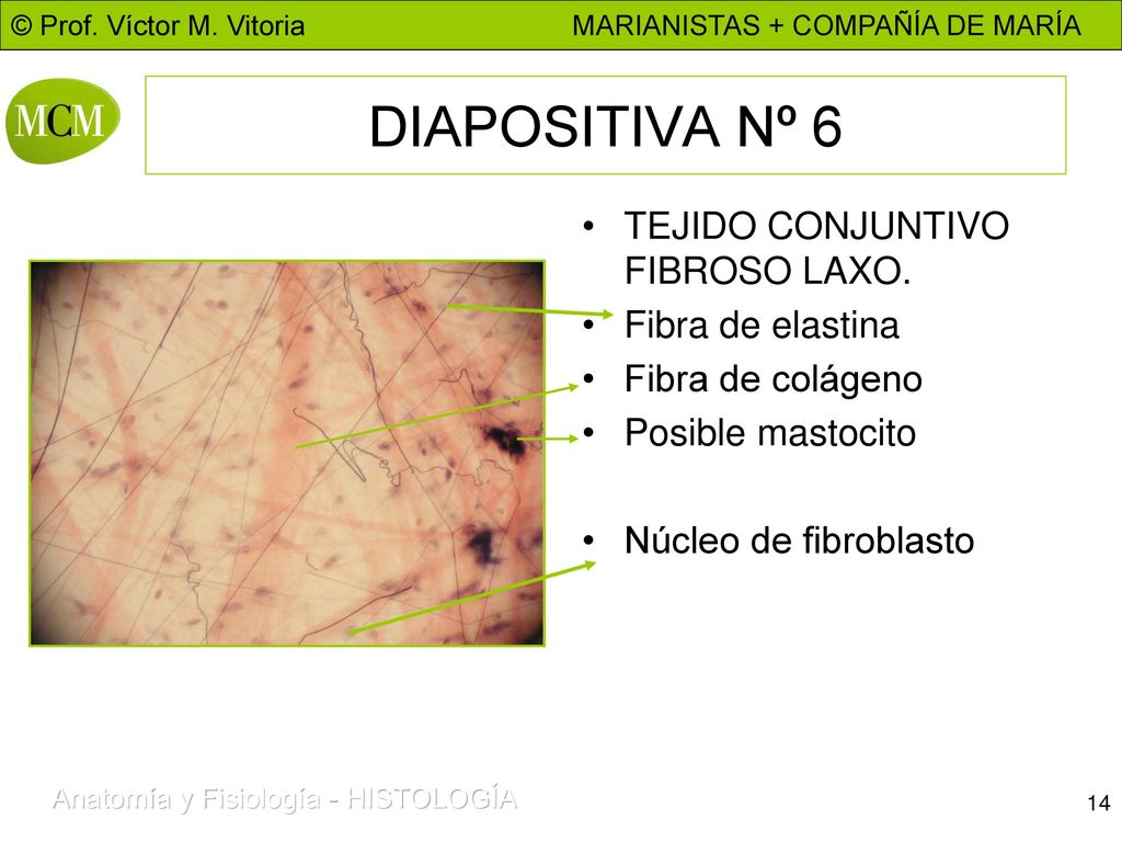 DIAPOSITIVA Nº 6 TEJIDO CONJUNTIVO FIBROSO LAXO. Fibra de elastina