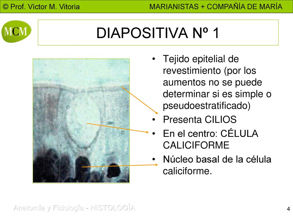 DIAPOSITIVA Nº 1 Tejido epitelial de revestimiento (por los aumentos no se puede determinar si es simple o pseudoestratificado)