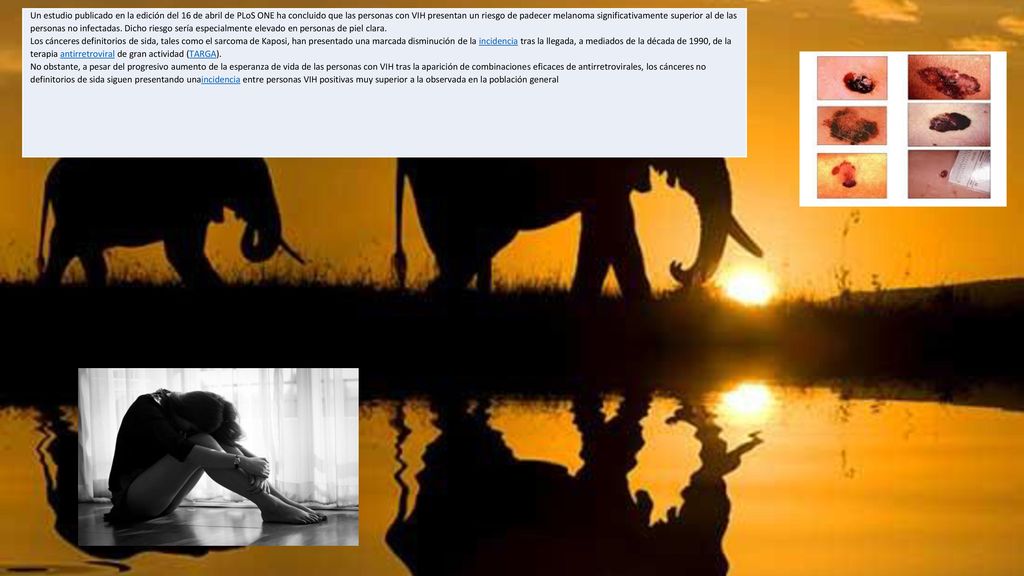 Un estudio publicado en la edición del 16 de abril de PLoS ONE ha concluido que las personas con VIH presentan un riesgo de padecer melanoma significativamente superior al de las personas no infectadas. Dicho riesgo sería especialmente elevado en personas de piel clara.