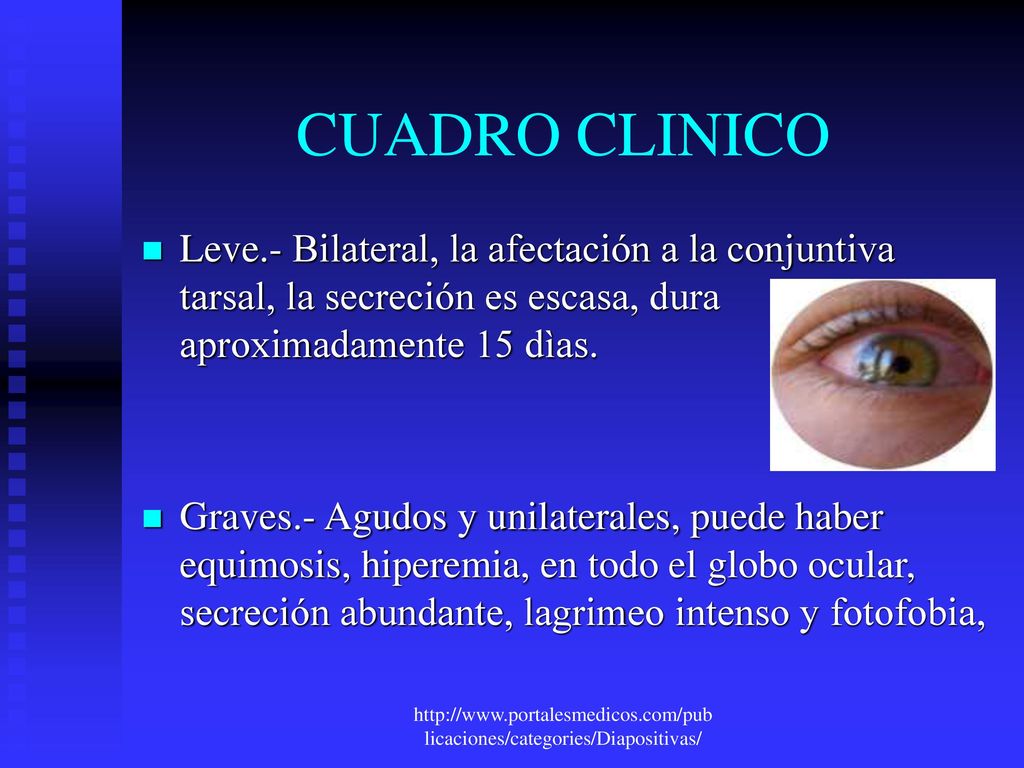 CUADRO CLINICO Leve.- Bilateral, la afectación a la conjuntiva tarsal, la secreción es escasa, dura aproximadamente 15 dìas.