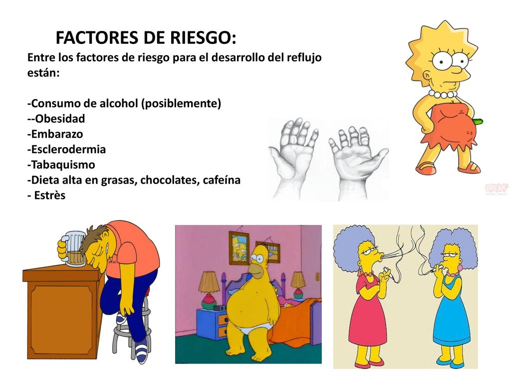 Entre los factores de riesgo para el desarrollo del reflujo están: