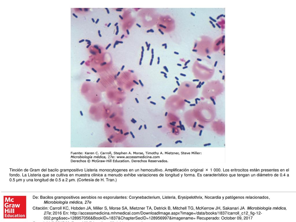 Tinción de Gram del bacilo grampositivo Listeria monocytogenes en un hemocultivo. Amplificación original × Los eritrocitos están presentes en el fondo. La Listeria que se cultiva en muestra clínica a menudo exhibe variaciones de longitud y forma. Es característico que tengan un diámetro de 0.4 a 0.5 µm y una longitud de 0.5 a 2 µm. (Cortesía de H. Tran.)