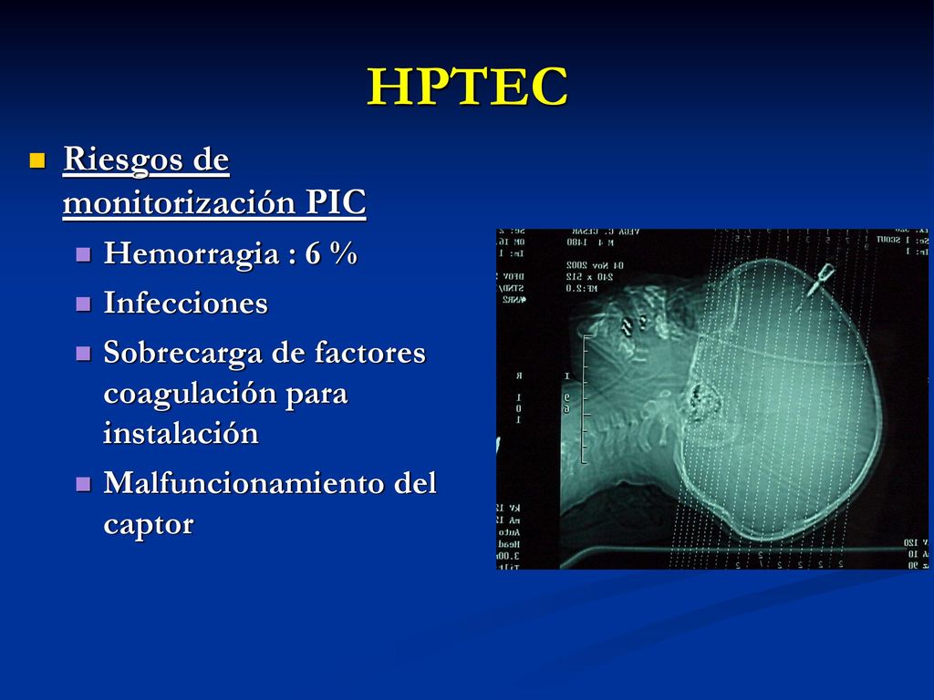 HPTEC Riesgos de monitorización PIC Hemorragia : 6 % Infecciones