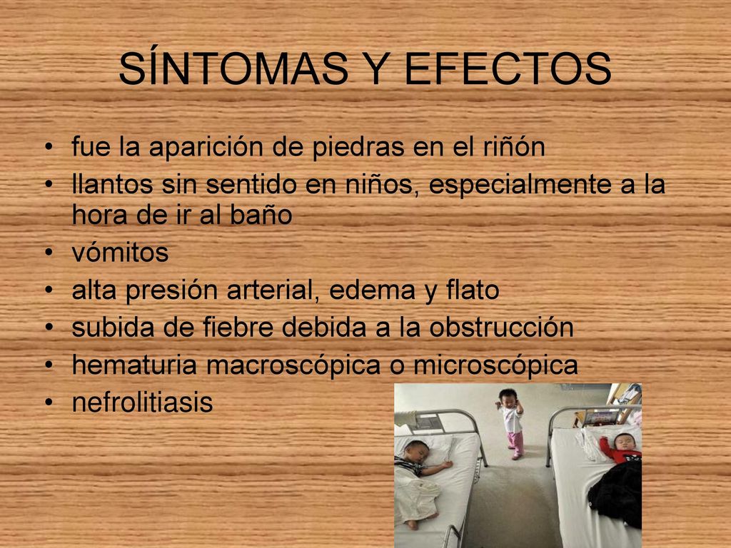 SÍNTOMAS Y EFECTOS fue la aparición de piedras en el riñón