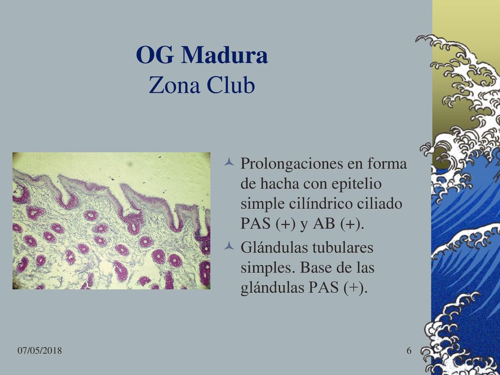 OG Madura Zona Club Prolongaciones en forma de hacha con epitelio simple cilíndrico ciliado PAS (+) y AB (+).