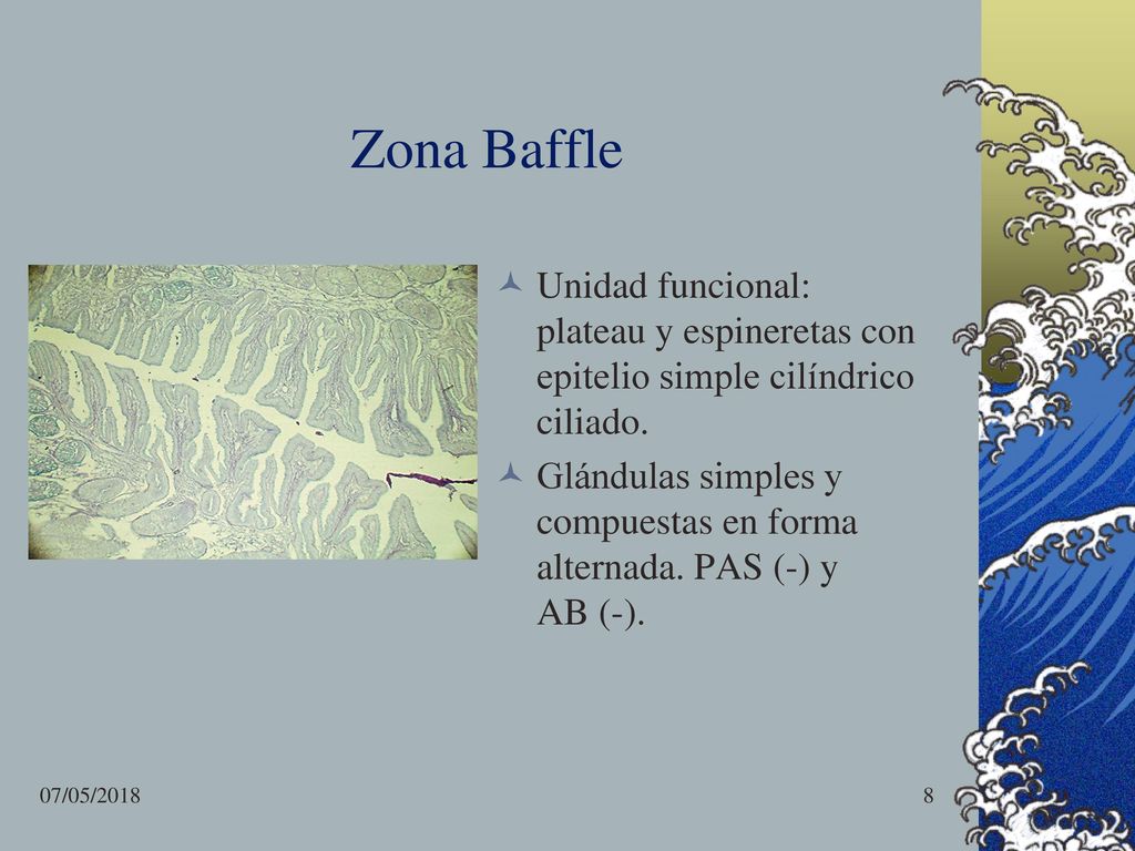 Zona Baffle Unidad funcional: plateau y espineretas con epitelio simple cilíndrico ciliado.