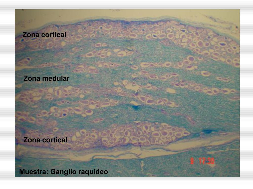 Zona cortical Zona medular Zona cortical Muestra: Ganglio raquídeo