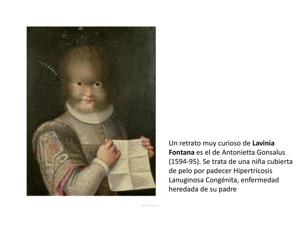 Un retrato muy curioso de Lavinia Fontana es el de Antonietta Gonsalus ( ).