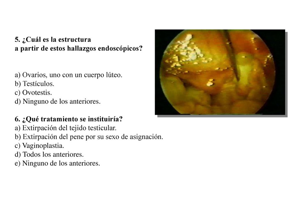 5. ¿Cuál es la estructura a partir de estos hallazgos endoscópicos a) Ovarios, uno con un cuerpo lúteo.