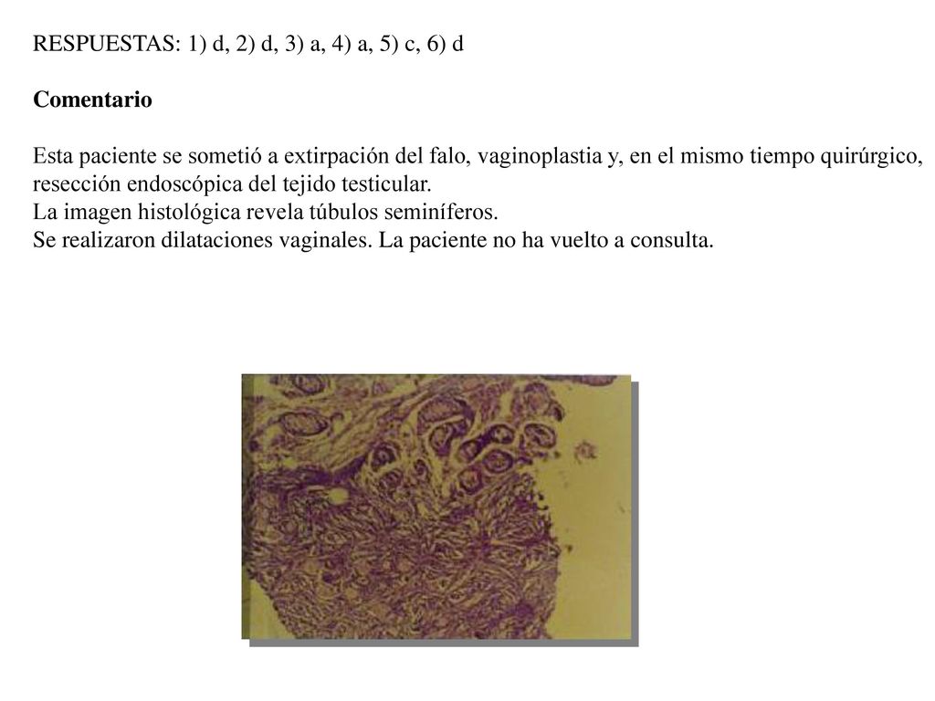 RESPUESTAS: 1) d, 2) d, 3) a, 4) a, 5) c, 6) d