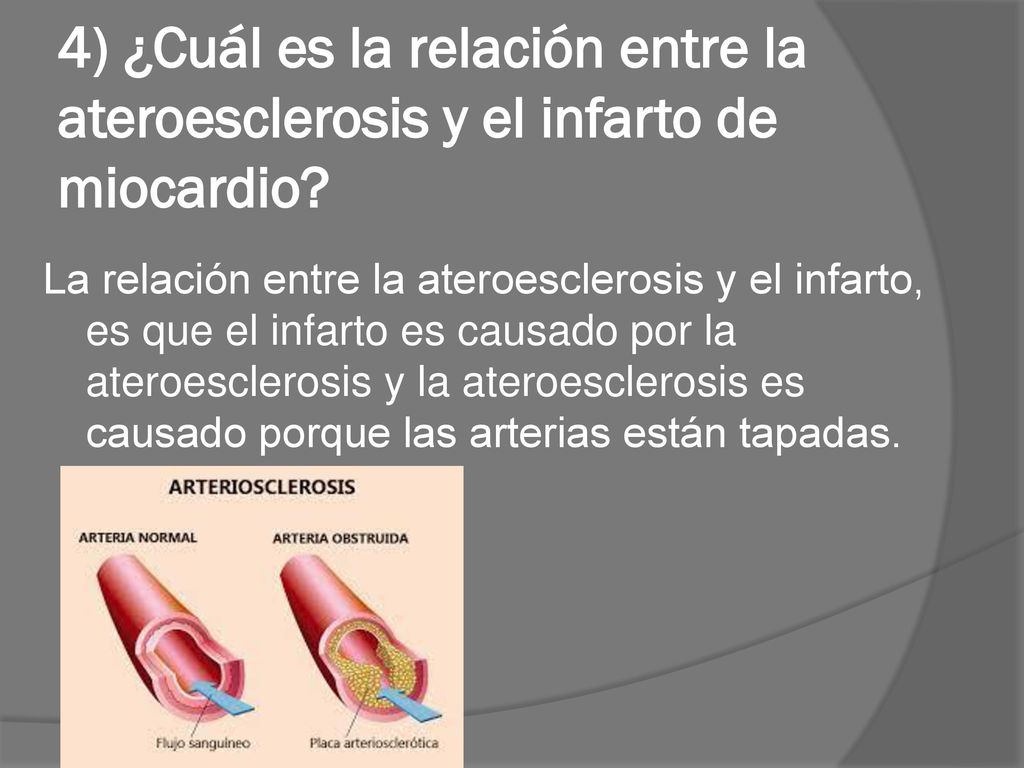 4) ¿Cuál es la relación entre la ateroesclerosis y el infarto de miocardio