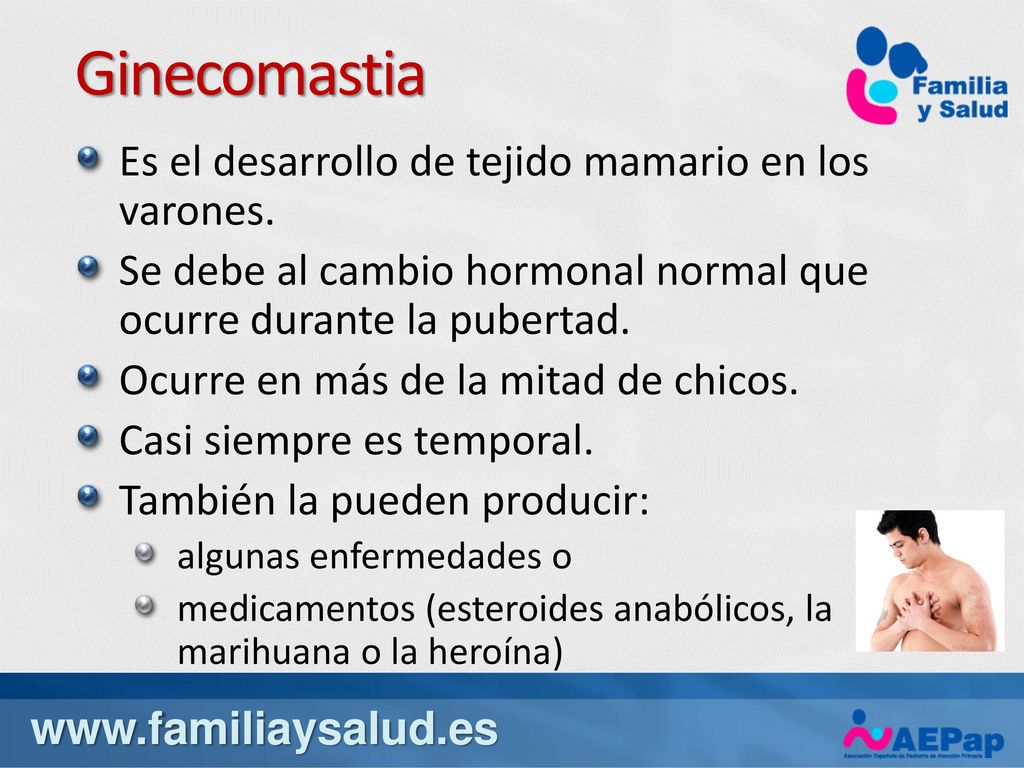 Ginecomastia Es el desarrollo de tejido mamario en los varones.