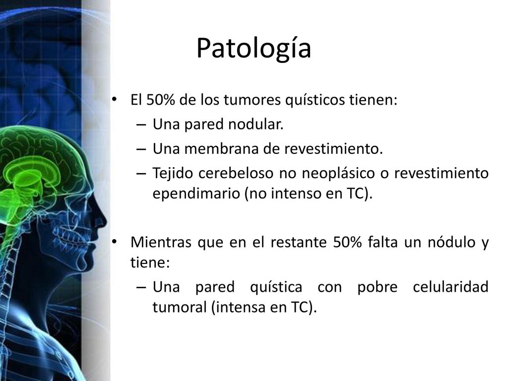 Patología El 50% de los tumores quísticos tienen: Una pared nodular.