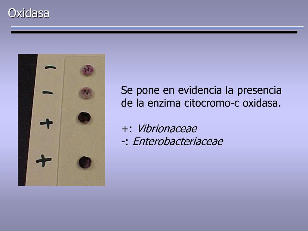 Oxidasa Se pone en evidencia la presencia de la enzima citocromo-c oxidasa.