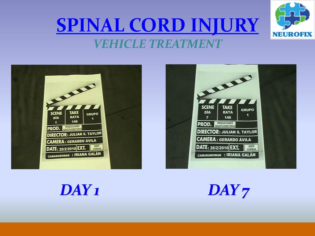 SPINAL CORD INJURY VEHICLE TREATMENT DAY 1 DAY 7