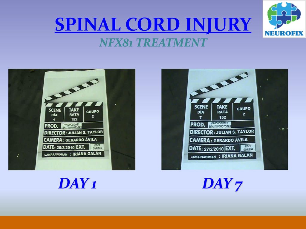 SPINAL CORD INJURY NFX81 TREATMENT DAY 1 DAY 7