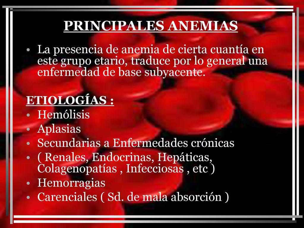 PRINCIPALES ANEMIAS La presencia de anemia de cierta cuantía en este grupo etario, traduce por lo general una enfermedad de base subyacente.