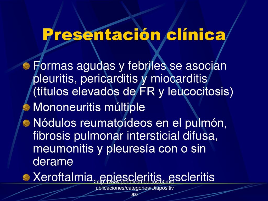 Presentación clínica Formas agudas y febriles se asocian pleuritis, pericarditis y miocarditis (títulos elevados de FR y leucocitosis)