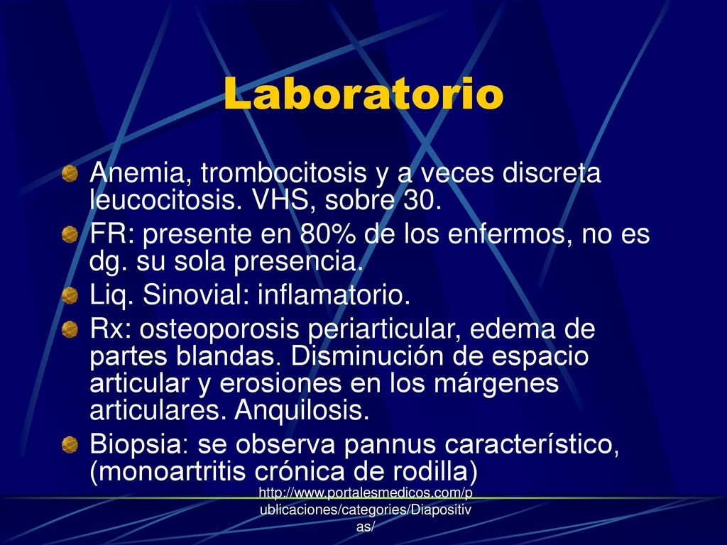 Laboratorio Anemia, trombocitosis y a veces discreta leucocitosis. VHS, sobre 30. FR: presente en 80% de los enfermos, no es dg. su sola presencia.