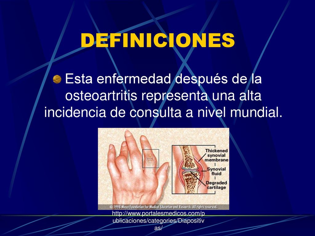 DEFINICIONES Esta enfermedad después de la osteoartritis representa una alta incidencia de consulta a nivel mundial.