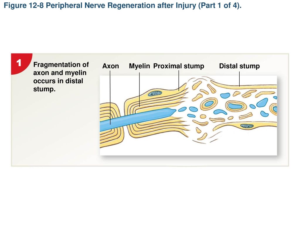 Figure 12-8 Peripheral Nerve Regeneration after Injury (Part 1 of 4).