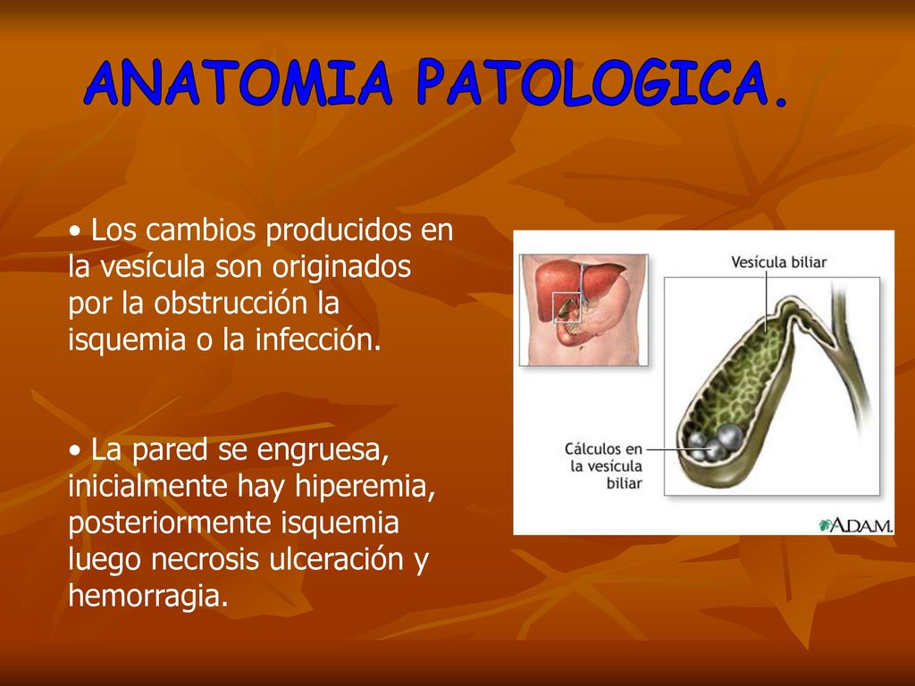 ANATOMIA PATOLOGICA. Los cambios producidos en la vesícula son originados por la obstrucción la isquemia o la infección.