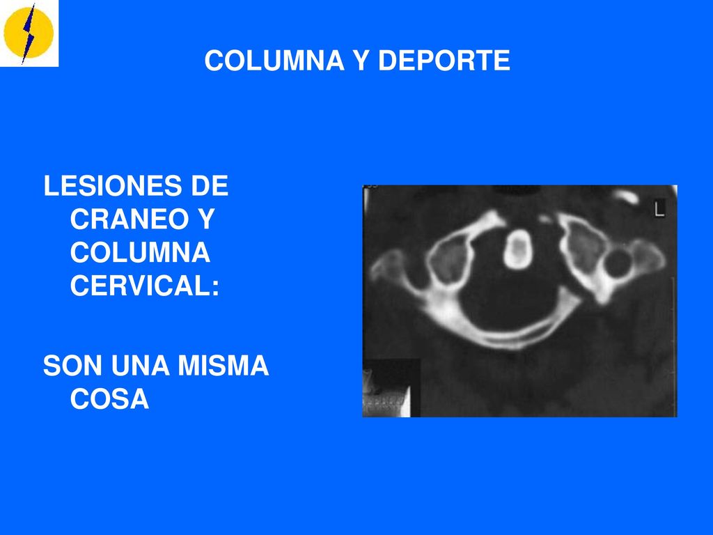 COLUMNA Y DEPORTE LESIONES DE CRANEO Y COLUMNA CERVICAL: SON UNA MISMA COSA