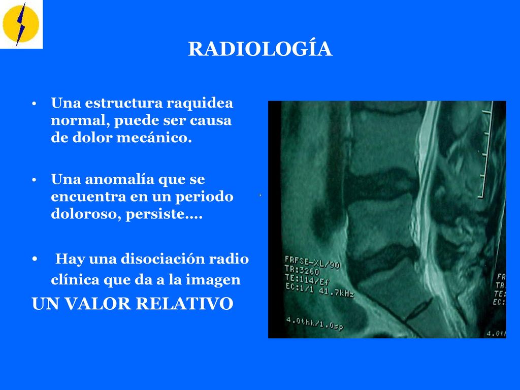 RADIOLOGÍA Hay una disociación radio clínica que da a la imagen
