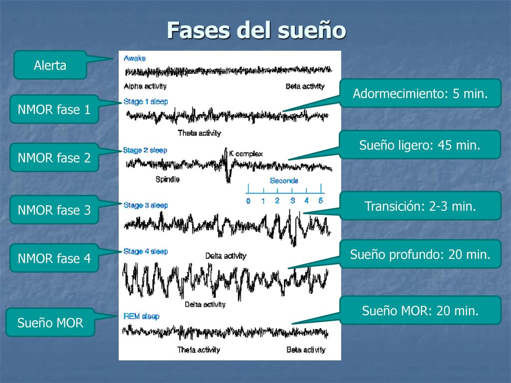 Fases del sueño Alerta Adormecimiento: 5 min. NMOR fase 1
