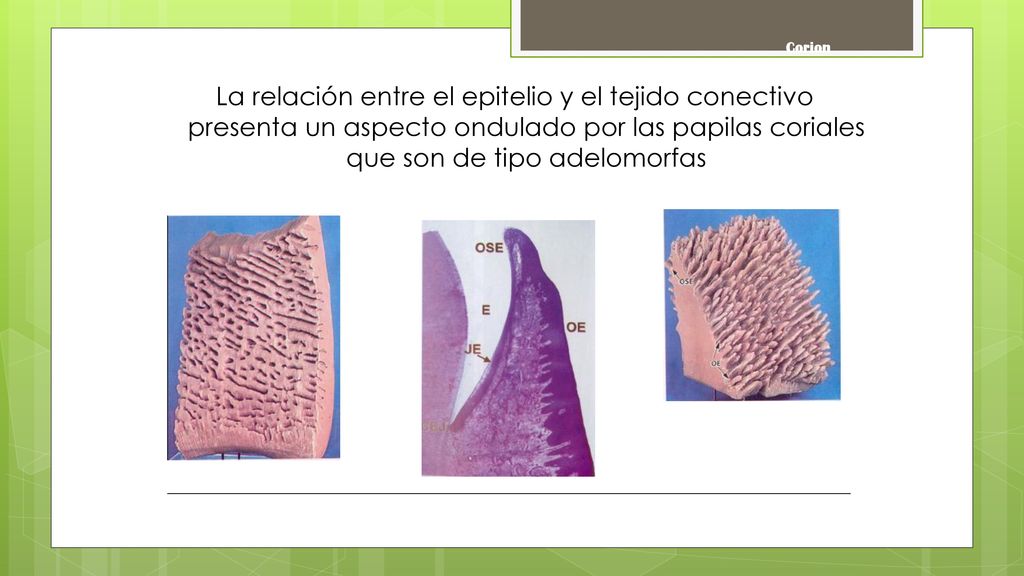 Corion La relación entre el epitelio y el tejido conectivo presenta un aspecto ondulado por las papilas coriales que son de tipo adelomorfas.