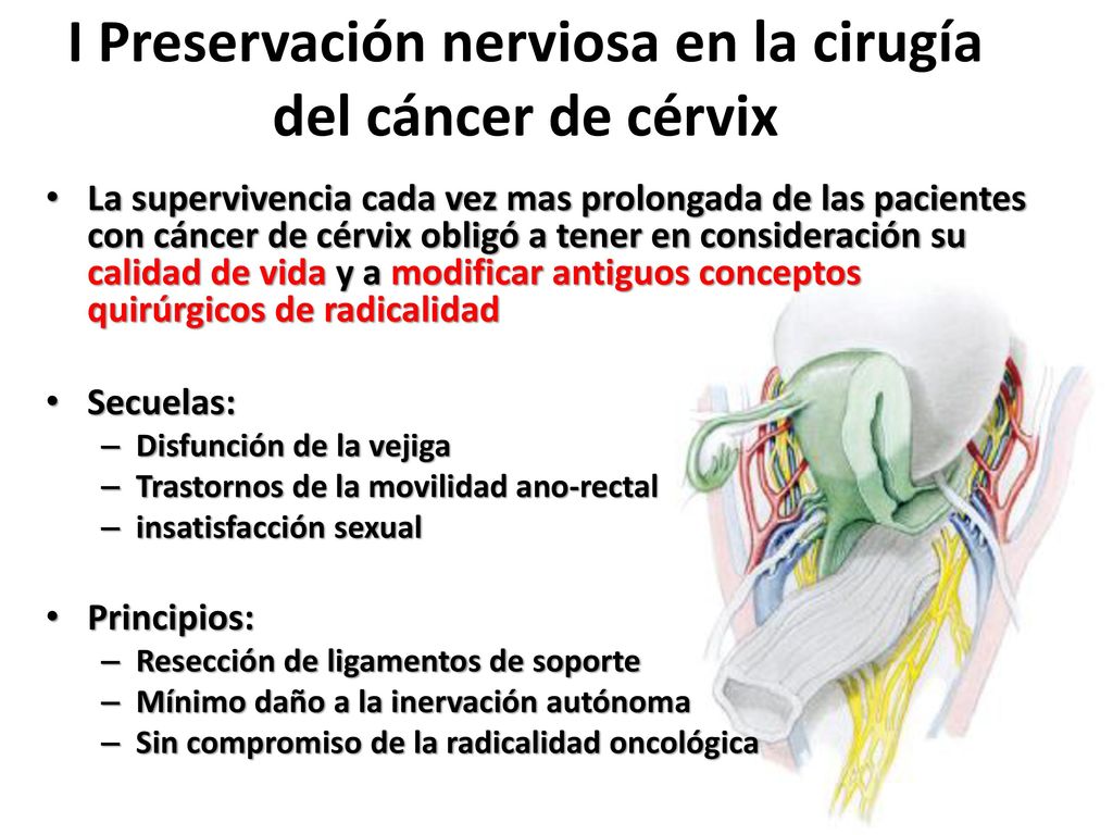 I Preservación nerviosa en la cirugía del cáncer de cérvix