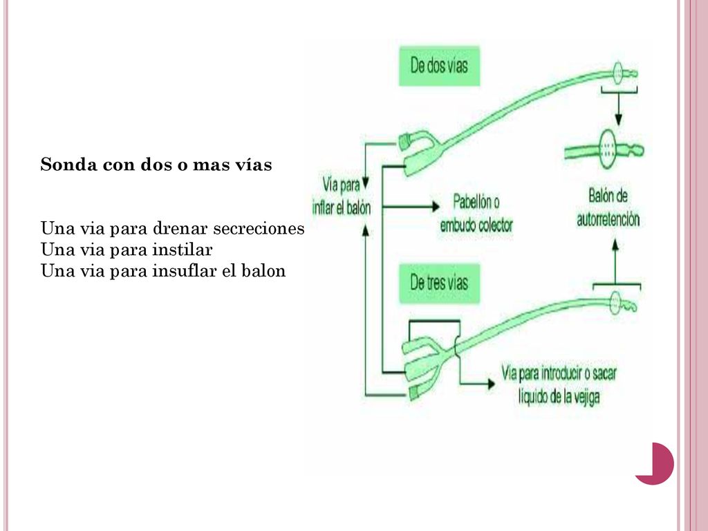 Sonda con dos o mas vías Una via para drenar secreciones.